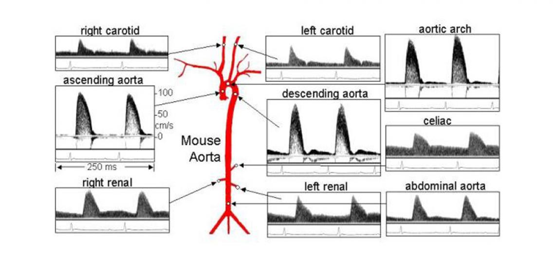 Doppler blood flow signals from several vessels in an anesthetized mouse