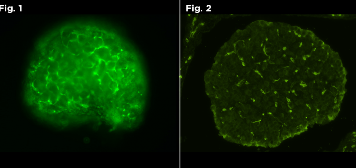 Figure 1: Live Fluorescent image of GFP positive neonate. Figure 2: Fluorescent image of GFP positive neonate.