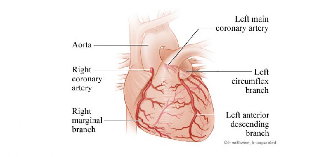 Coronary Artery Bypass