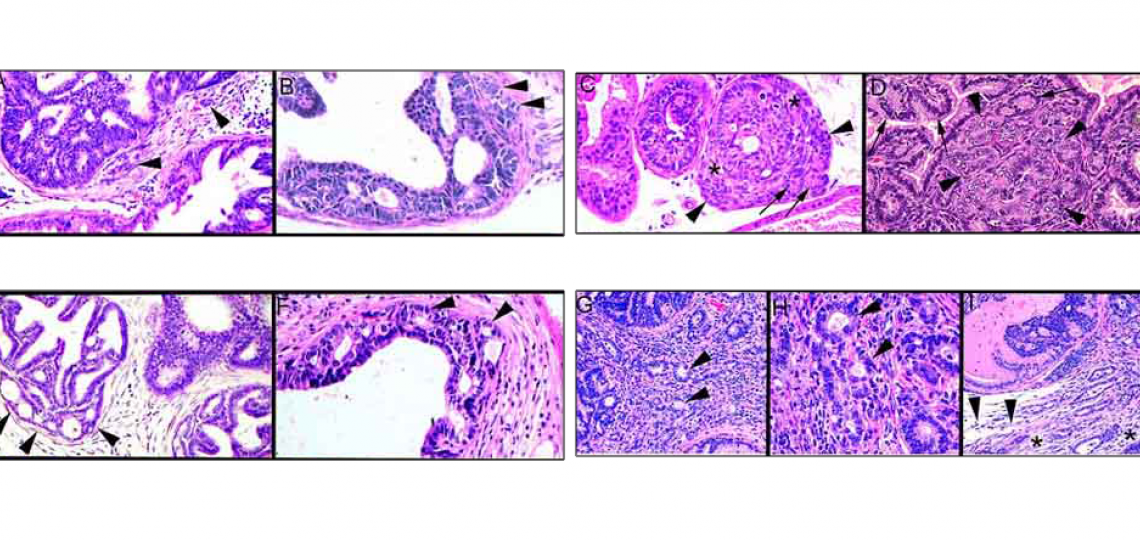 Mouse Models Of Prostate Cancer