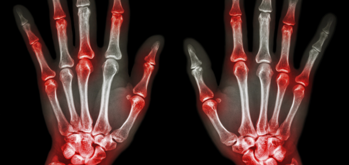 Finger and joint pain