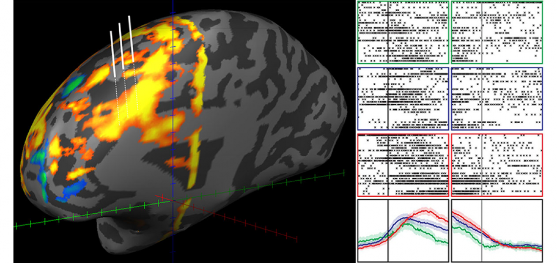 Investigating the physiology of controlled decision-making in human prefrontal cortex