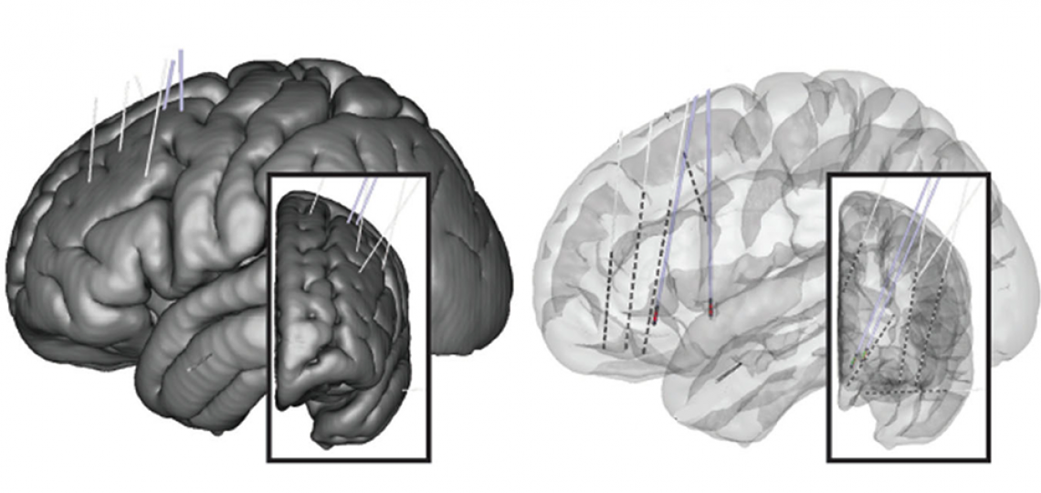 Developing novel targets and indications for neuromodulation Developing novel targets and indications for neuromodulation