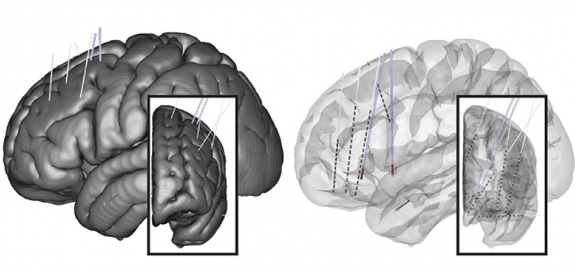 Developing novel targets and indications for neuromodulation