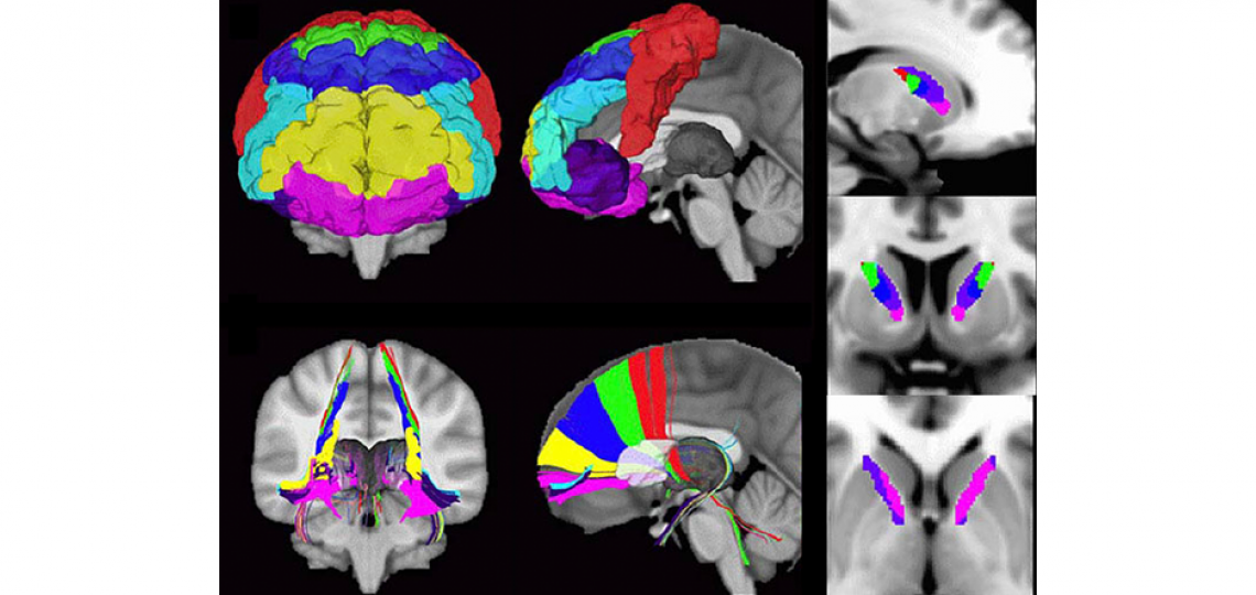 Investigating cortical and basal ganglia networks Investigating cortical and basal ganglia networks