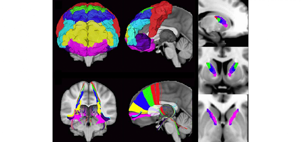 Investigating cortical and basal ganglia networks