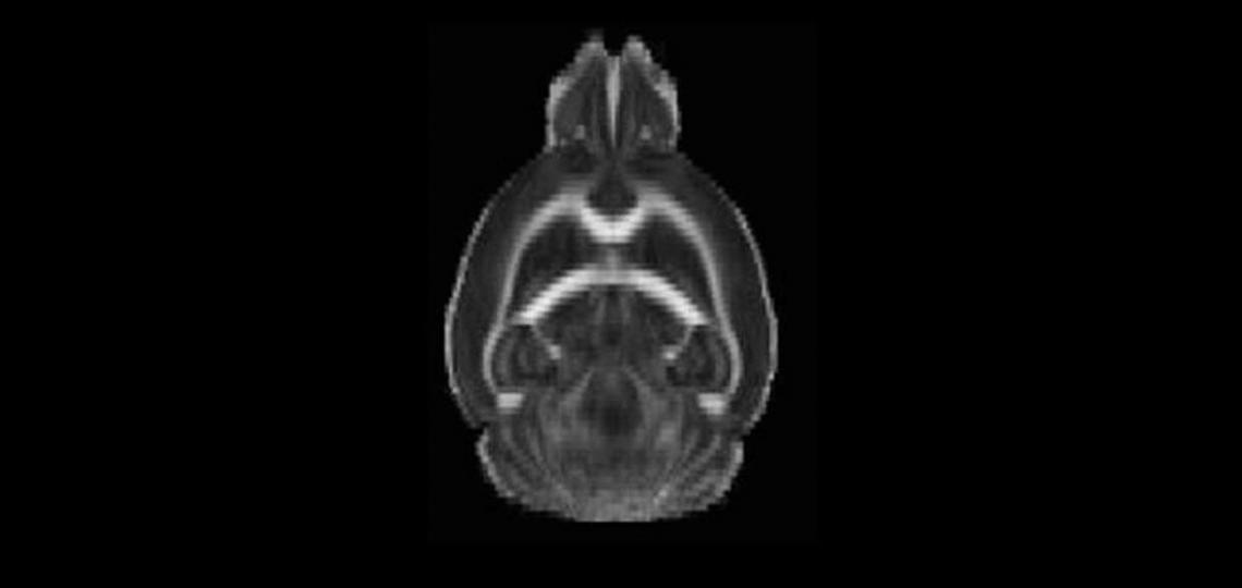 Fractional Anisotropy Map in Mouse Brian for White Matter Tractography