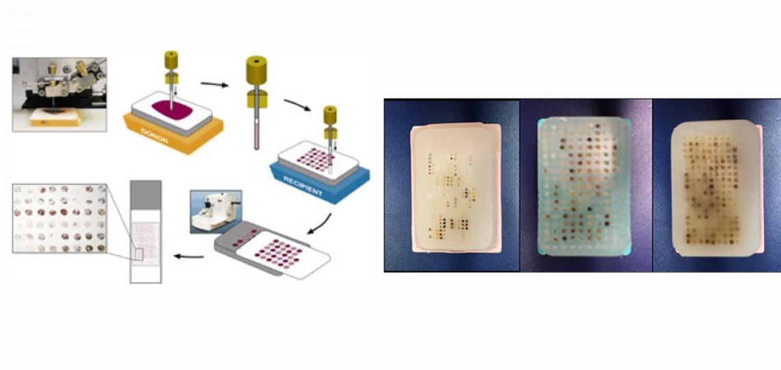 TMAs using human or animal model tissues