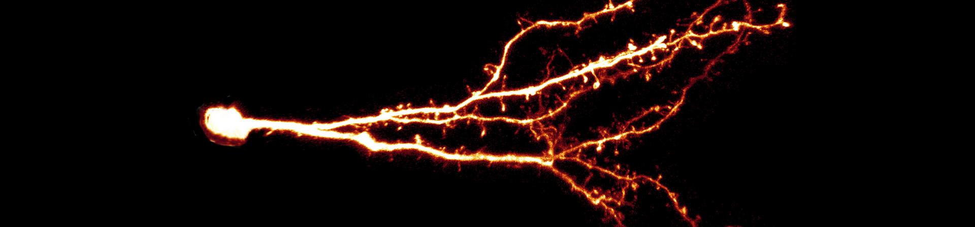 Adult-born neuron in the mouse olfactory bulb
