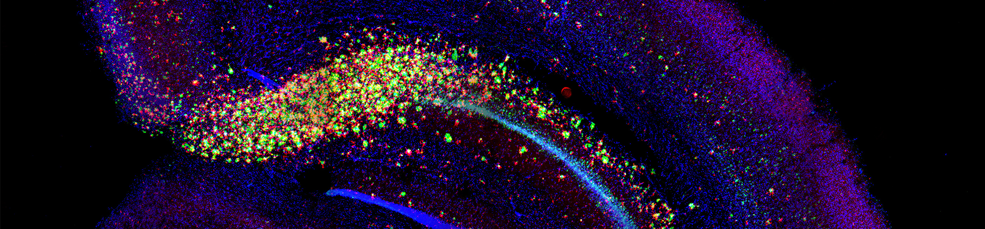 Staining of microglia surrounding amyloid plaque in a Alzheimer's disease mouse model