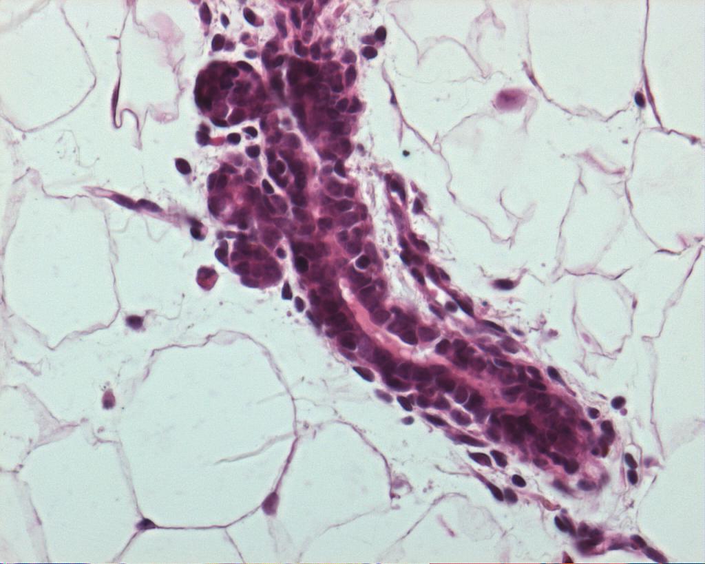 H&E staining of the epithelial bilayer of the mammary gland