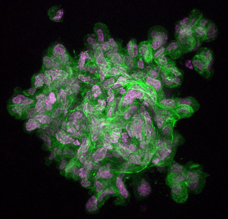 Phalloidin staining of F-actin within a breast tumor organoid