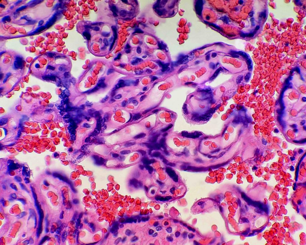 “The Flow of Life”, Chorionic villi in placenta with H&E stain