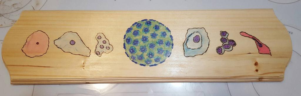 “HPV: Transformation to Malignancy”, Woodburning on pine with watercolor pencil. People's Choice Trainee Award