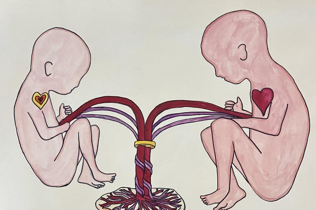 “Twin to Twin Transfusion syndrome”, Watercolor