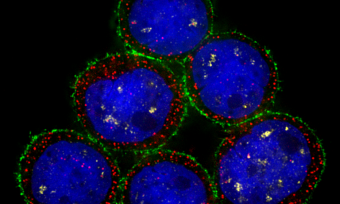 MDA-MB-453 human breast cancer cells