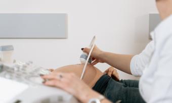pregnant woman ultrasound