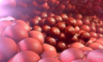 Closed up illustration of cancer cells