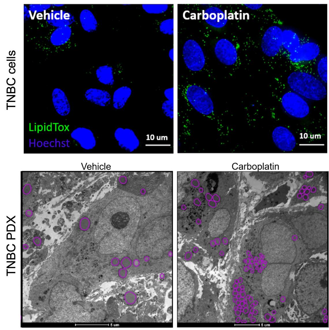 Chemotherapy-induced lipid metabolic alterations in residual TNBC