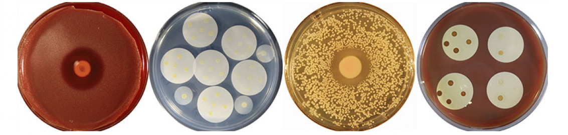 An image of cocultivation assays with human nasal bacterial isolates.