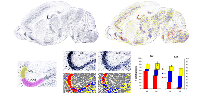 Automated image analysis and quantitation of gene expression