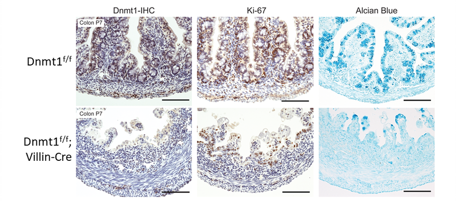 Dnmt1 deficiency leads to severe intestinal abnormalities in mouse neonates. Dnmt1 deficiency leads to severe intestinal abnormalities in mouse neonates.