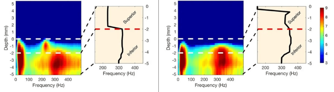 Graphs and charts showing that Power spectra of TD patients differ from PIGD patients