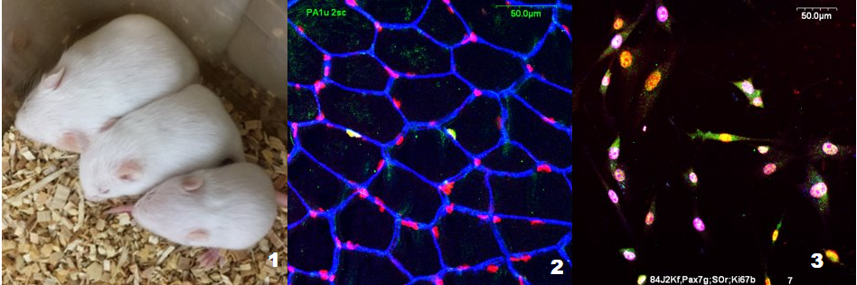 Regulation of skeletal muscle satellite cell function by protein intake during the postnatal period​