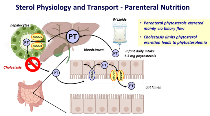 Illustration of Parenteral Nutrition and Cholestatic Liver Disease