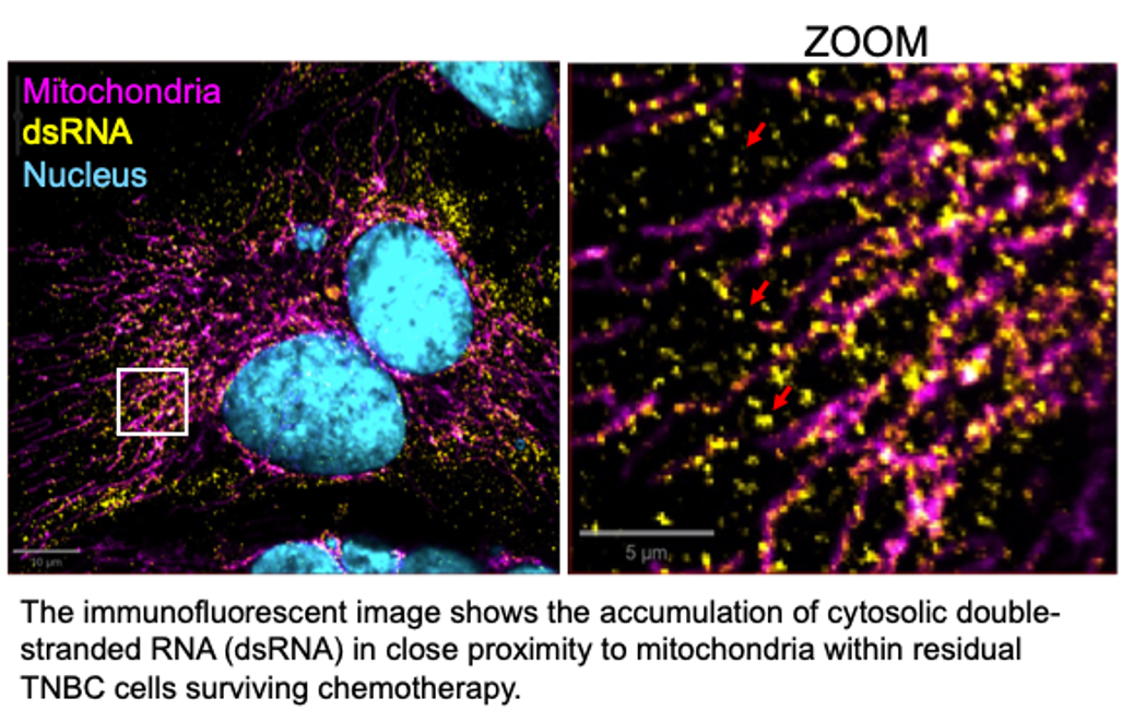 image shows the accumulation of cytosolic double-stranded RNA in close proximity to mitochocndria within residual TNBC cells surviving chemotherapy