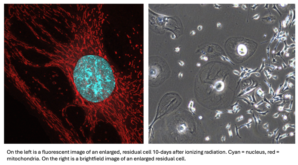 image of Radiation Therapy impacting mitochondrial and metabolic rewiring in TNBC