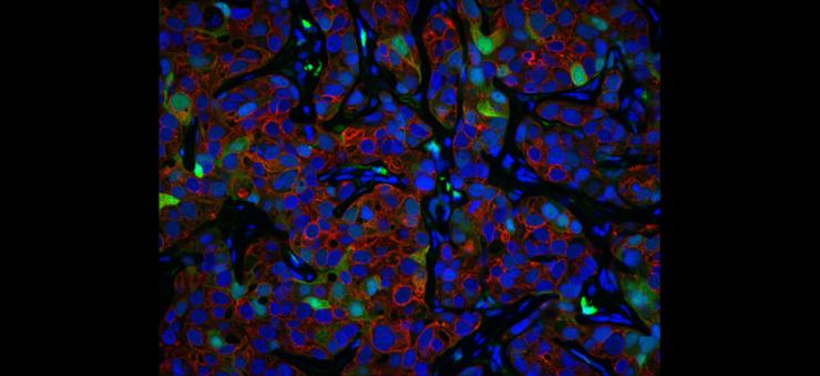 Co-immunofluorescence co-immunofluorescence-PDX