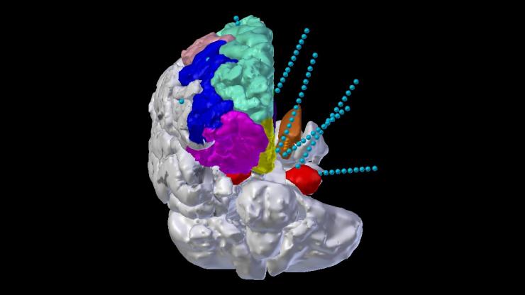 Advanced surgical neuroimaging