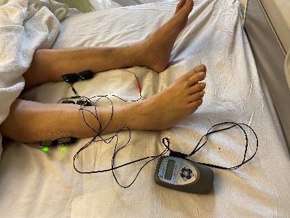 Daily use of electrical stimulation therapy to prevent ICU acquired weakness 