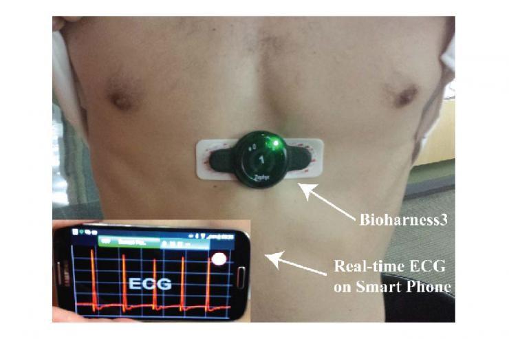 Stress Analysis in Surgery Resident: Assessing Heart Rate Response as a Result of Intervention or Disorder