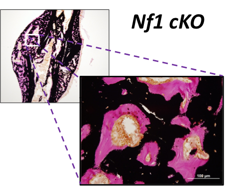 Impaired bone mineralization (pink) in Nf1-deficient fracture calluses 