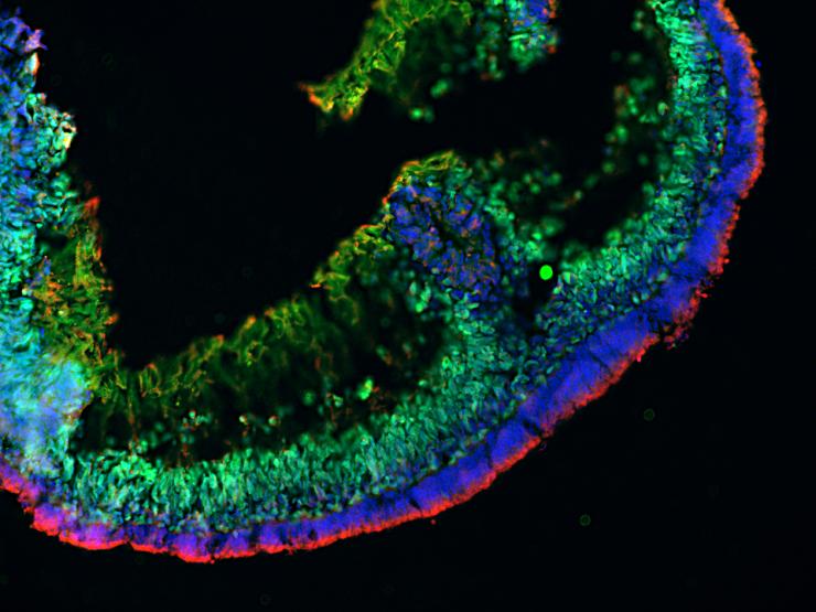 Organoid Microscopy Image