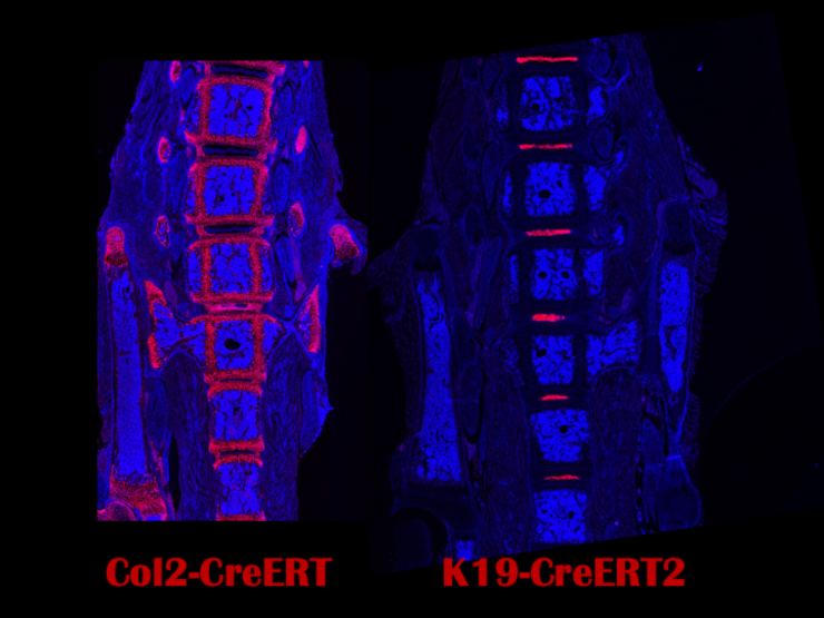 A side-by-side digital image of a spine, each with pink highlights identifying different aspects.