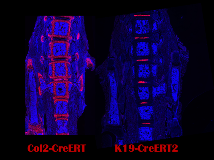 A side-by-side digital image of a spine, each with pink highlights identifying different aspects. 