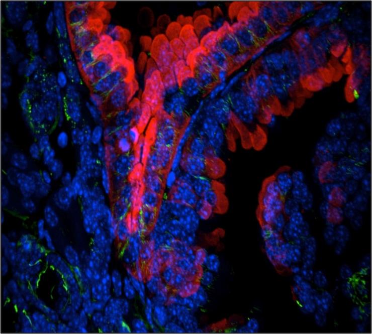 Frozen mouse kidney section stained to demonstrate a cystic kidney phenotype