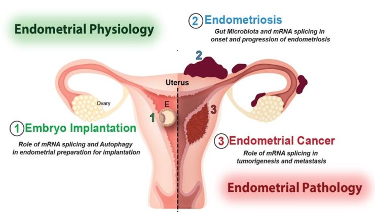 Illustration of the intersection between Endometrial Physiology and Endometrial Pathology