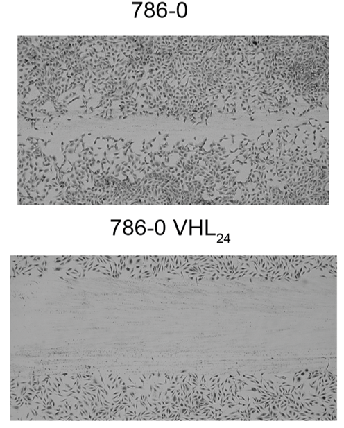 Wound healing assay Wound healing assay to evaluate cellular migration.
