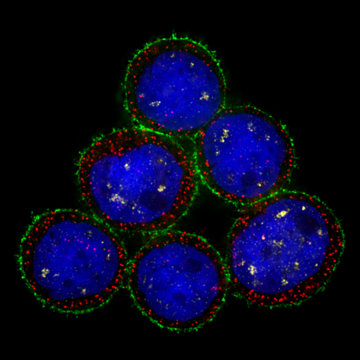 MDA-MB-453 human breast cancer cells