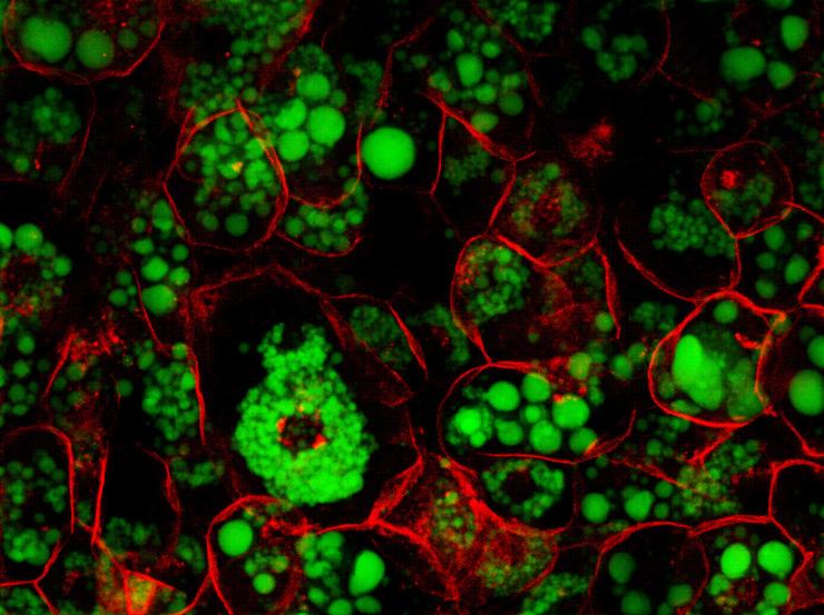 Supraclavicular brown adipocytes with lipid droplets.