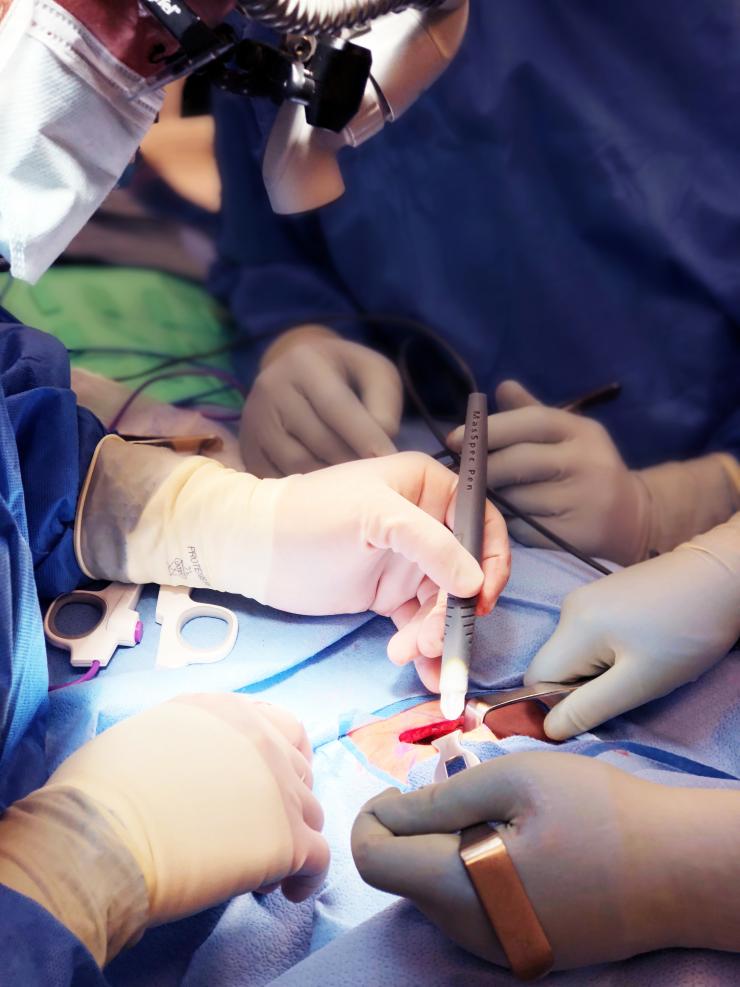 A team of surgeons using a Mass Spec Pen during surgery
