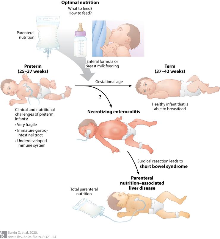 Clinical and nutritional challenges of preterm infants. Shown is an overview of the fundamental choices of how and what to feed preterm compared to term infants. These choices include intravenous parenteral nutrition (i.e., TPN) or enteral nutrition composed of infant formula or breast milk)