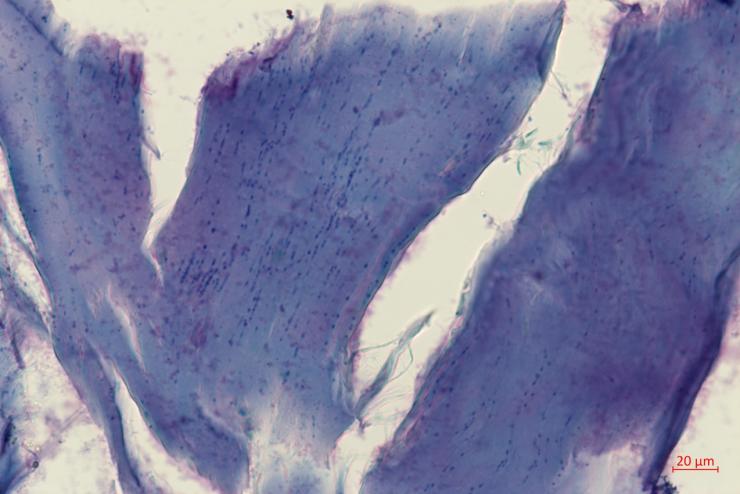 Microscope image of subdermal muscle from a skin of a 52,000-year-old mammoth showing remnants of mammoth nuclei. The Cell study shows that fossils of ancient chromosomes survive in this skin sample. 