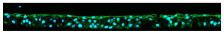 bladder organoids in blue and green