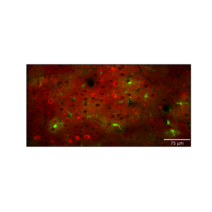 illustration showing local changes in neural activity and global neuromodulatory signals