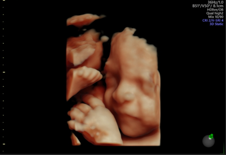 OBGYN Ultrasound 2025